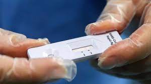 Compreenda o que distingue os testes moleculares, dos de antigénio e dos serológicos. Covid 19 Farmacias Venderam Mais De Um Milhao De Testes Rapidos Observador
