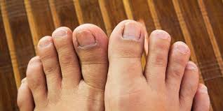 Jul 23, 2019 · feet come in many shapes and sizes. Weird Things That Can Happen To Your Toenails And Feet Women S Health