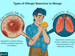 Mango Allergy Symptoms Causes Diagnosis Treatment