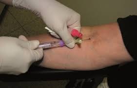 Praxisanleitung Blutabnahme Klinik Via Medici