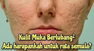 Kata orang, kalau hendak kulit tegang sentiasa kenalah rajin urut muka. Cara Menegangkan Kulit Muka Kendur Saggy Dengan Semulajadi Serimuslimah Sihat