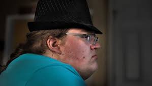 Disability Employment