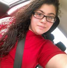 Laser hair removal for PCOS facial hair removal