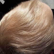 Blonde hair colors are becoming more and more impressive every year. Calling All Geneticists Help Me Understand The Way My Mixed Race Child Looks Mumsnet