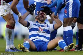 Tyrone mings should hang his head in shame for one of the most cowardly acts i have seen on a football pitch in many a year, stated mcgrath. Reading Striker Nelson Oliveira Slams Fa For Not Punishing Tyrone Mings For Stamp Daily Mail Online