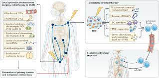 Survival rates for prostate cancer. Cytoreductive Treatment Strategies For De Novo Metastatic Prostate Cancer Nature Reviews Clinical Oncology