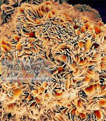 Smaller the size of a stone, the faster it can pass through the urinary tract. Recurrent Kidney Stones Causes And Management Renal Fellow Network