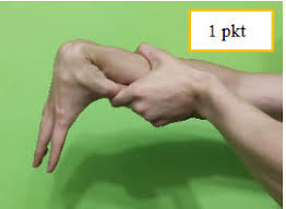 Tkanka łączna wspomaga skórę, mięśnie, więzadła i narządy ciała. Wiotkosc Stawow Czy Przeprost Kolan Jest Zly Fizjoklinika