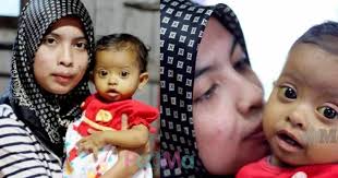 Mula start dengan demam panas sampai suhu 40c. Kalau Anak Dijangkiti Chickenpox Ini Yang Patut Anda Lakukan Untuk Merawatnya Pa Ma