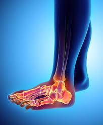Image result for Foot Pain