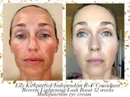Rodan and Fields by Gretchen