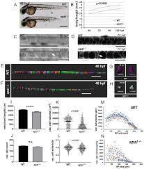 The solution that fills the vacuole is called cell sap. Notochord Vacuoles Absorb Compressive Bone Growth During Zebrafish Spine Formation Elife