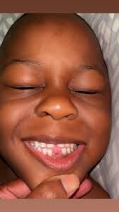 Help!! 6yrs old loosing first tooth. Not emotionally processing it well