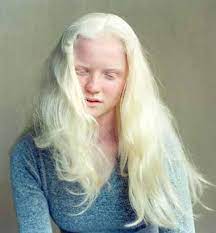 When the hair grows back, it tends to be white due. Why Is It So Hard To Get White Albino Hair Daz 3d Forums