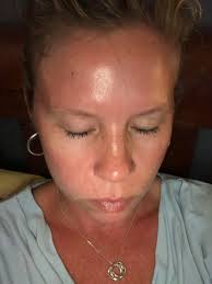 I'm so amazed this worked !!