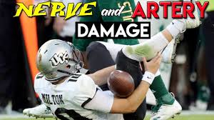 While swelling is not necessarily a bad thing, it can cause discomfort. Worst College Football Injury Ever Doctor Reviews Mckenzie Milton Injury Youtube