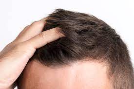 How Long Does It Take For Hair To Grow Back? The Complete Guide - Elmens