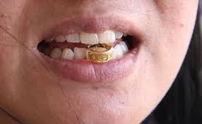 Dacă rămâne aurie și strălucitoare, este aur veritabil, dar dacă își pierde luciul și capătă. Cum SÄ DeterminaÈi Autenticitatea Aurului AcasÄ Cum SÄ VerificaÈi Autenticitatea Aurului AcasÄ