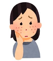 肌荒れに悩む人のイラスト | かわいいフリー素材集 いらすとや