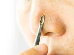 Check spelling or type a new query. Watch Dr Pimple Popper Extract The Deepest Blackhead We Ve Ever Seen Allure