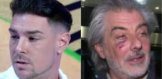 Jacobo Ostos desmiente haber agredido a su hermano Jaime: "La herida de la  cara se la hace él"