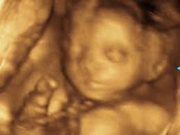 What Happens If The Umbilical Cord Is Around My Baby S Neck Your Pregnancy Matters Ut Southwestern Medical Center