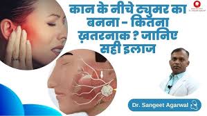 कानदर्द को हल्के में ना ले, sugar ,पर्दे की सूजन से लेकर cancer तक में हो  सकता हैं कानदर्द .EarPain