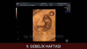 9 gebelik haftasinda iki aylik bebek ultrason ve 4 boyutlu goruntuleri bebek hareket ediyor youtube