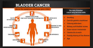 However, people with bladder cancer often don't see blood in their urine. Bladder Cancer Causes Symptoms And Treatments