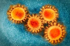 Findings were published in jama internal medicine on february 24, 2021. Why Does Sars Cov 2 Spread So Easily