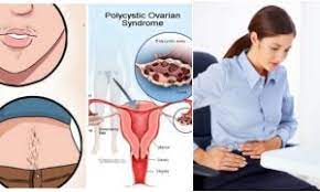 Maybe you would like to learn more about one of these? 7 Tanda Awal Kanser Ovari Yang Disangka Sakit Biasa Wanita Kena Tahu