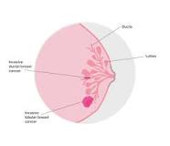 Image result