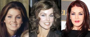 We did not find results for: Priscilla Presley Plastic Surgery Before And After Pictures 2021