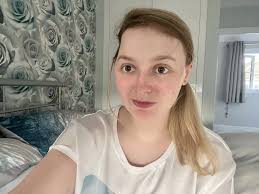 Beauty queen, 22, who suffered from intense headaches later told she has  brain tumour