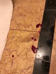 Maybe you would like to learn more about one of these? Blood On The Floor After Stepping On Glass In My Hotel Room Which Was Not From Us Picture Of Fairmont San Francisco Tripadvisor