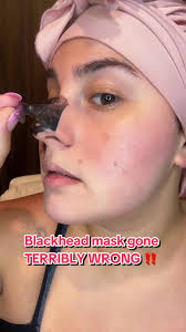 this probably couldn’t have gone worse ☹️ #blackheadmask #porestrip  #skincare #beautytok #tiktokshop #productreview