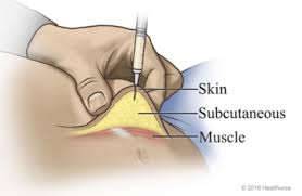 Image result for Subcutaneous Injection