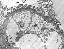 The glomerular basement membrane (gbm) is a specialized structure with a significant role in maintaining the glomerular filtration barrier. Genetic Diseases