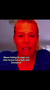 Emmanuel Scalped Fight