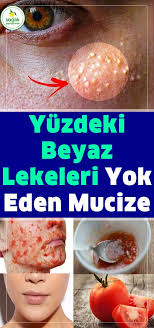 Pin By Aygun Adas On Saglik Diet And Nutrition Healthy Lifestyle Healthy Recipes