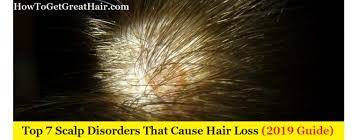 There are causes of hair loss that may not cause any pain. Top 7 Scalp Disorders That Cause Hair Loss 2020 Guide How To Get Great Hair