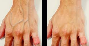 These are the steps (to make your veins pop) that work for everybody. Why Do Some People S Veins Appear Through Their Skin