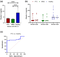 Other symptoms only tend to occur after the condition has reached an advanced stage, and may include: A Circulating Levels Of Fibulin 1 In Papillary Thyroid Cancer Ptc Download Scientific Diagram