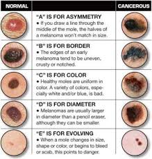 Rough and wartlike, they're small and develop like the actinic keratosis lesions that often precede it, squamous cell carcinoma grows in areas that get lots of sun. Skin Cancer Treatment Chesapeake Bay Ent