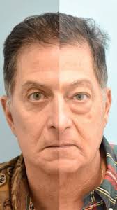 The Graivier Center Plastic Surgery and MedSpa (@graiviercenter) ·  Alpharetta, GA