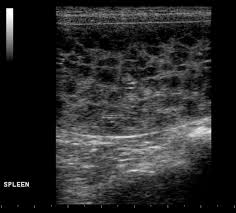 Because of this, the tumor can rupture, leading to sudden and severe hemorrhage, collapse, and rapid death. Top 5 Causes Of Splenomegaly In Dogs Clinician S Brief