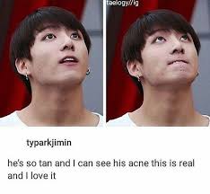 I Love His Acne And His Skin It S So Cute Omg Bts Bts Bangtan Boy Bts Memes