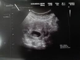 Seperti judul tulisanku, aku ingin sharing tentang pengalaman kehamilan pertamaku nih. Pengalaman Mengandung Anak Pertama Baby Thaqif