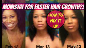 The idea of using monistat products for hair growth was so popular that it also peaked the interest of myfox houston, a local news station for houston, texas. How To Mix Monistat For Faster Hair Growth Youtube