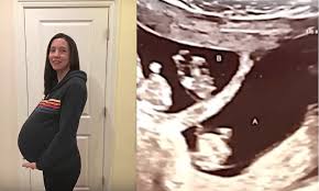 Mange ønsker at det skal gå fort å bli gravid etter at de har. Moren Er Gravid Med Trillinger Men Det Legene Finner Ut Pa Ultralyden Sjokkerer Dem Alle Onlinenytt